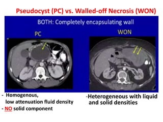 - Homogenous,
low attenuation fluid density
- NO solid component
Pseudocyst (PC) vs. Walled-off Necrosis (WON)
-Heterogeneous with liquid
and solid densities
 