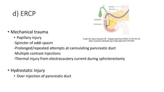 d) ERCP
• Mechanical trauma
• Papillary injury
-Spincter of oddi spasm
-Prolonged/repeated attempts at cannulating pancreatic duct
-Multiple contrast injections
-Thermal injury from electrocautery current during sphicterectomy
• Hydrostatic injury
• Over injection of pancreatic duct
 