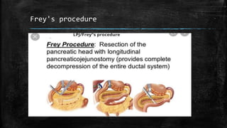 Frey's procedure
 