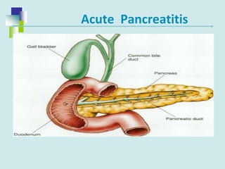 Acute Pancreatitis
 