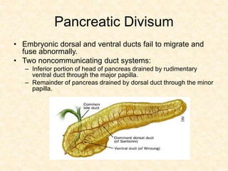 Pancreatic Divisum
• Embryonic dorsal and ventral ducts fail to migrate and
fuse abnormally.
• Two noncommunicating duct systems:
– Inferior portion of head of pancreas drained by rudimentary
ventral duct through the major papilla.
– Remainder of pancreas drained by dorsal duct through the minor
papilla.
 