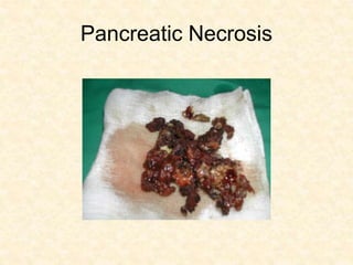 Pancreatic Necrosis
 