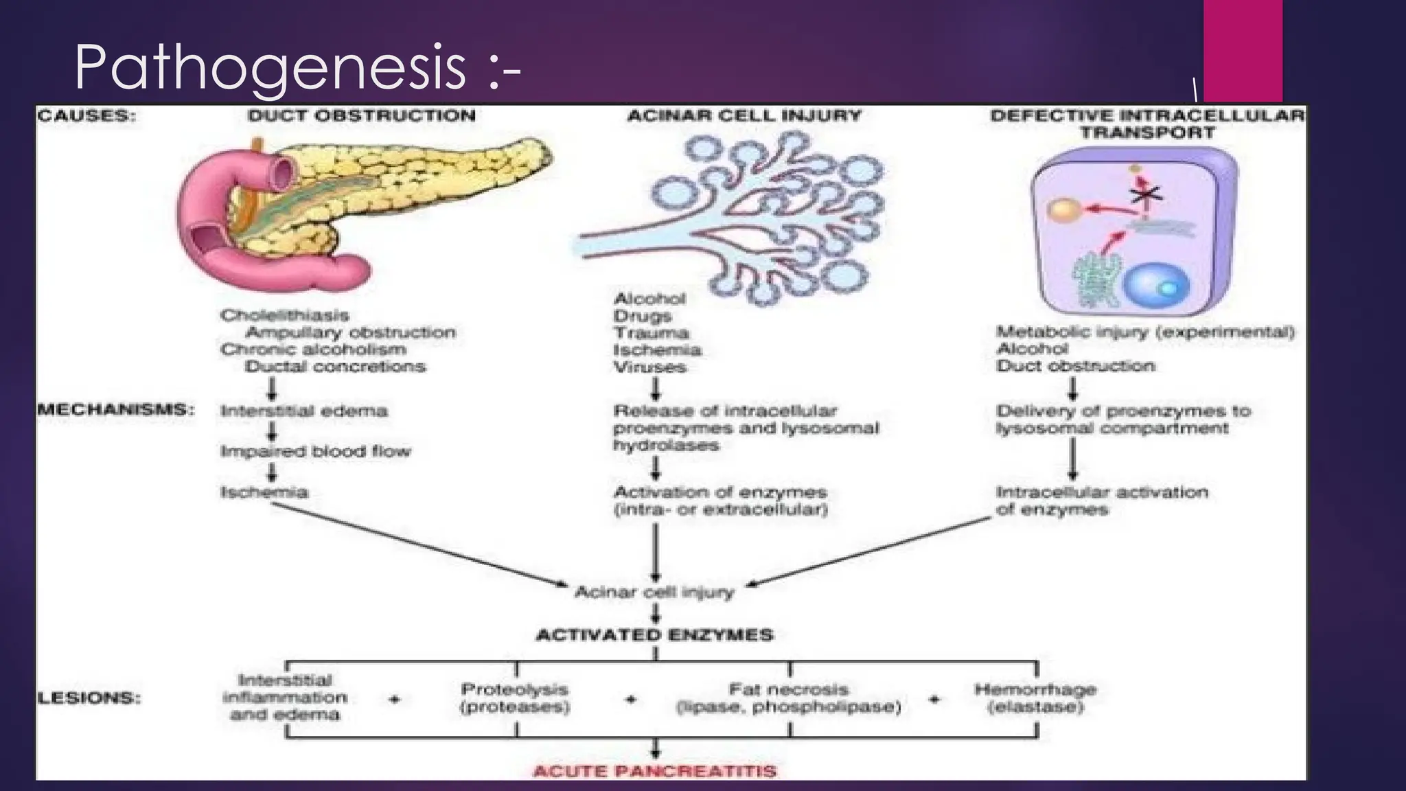 Comprehensive Understanding of Acute Pancreatitis | PPTX