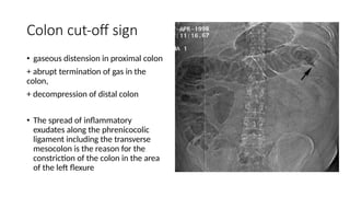 Colon cut-off sign
• gaseous distension in proximal colon
+ abrupt termination of gas in the
colon,
+ decompression of distal colon
• The spread of inflammatory
exudates along the phrenicocolic
ligament including the transverse
mesocolon is the reason for the
constriction of the colon in the area
of the left flexure
 