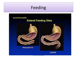 FeedingFeeding
Acute Pancreatitis
 