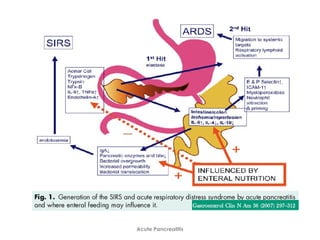 Acute Pancreatitis
 
