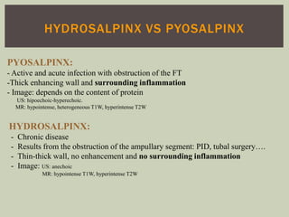 Acute female pelvic infection . ESUR Congress. | PPTX