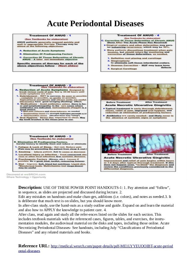 Acute Periodontal Diseases