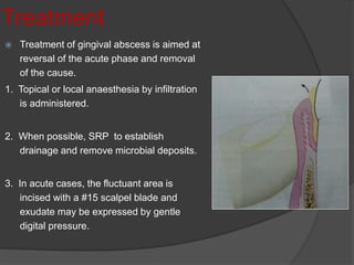 Acute periodontal Infections | PPTX