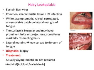 Hairy Leukoplakia 
• Epstein Barr virus 
• Common, characteristic lesion-HIV infection 
• White, asymptomatic, raised, corrugated, 
unremovable patch on lateral marigns of 
tongue 
• The surface is irregular and may have 
prominent folds or projections, sometimes 
markedly resembling hairs 
• Lateral margins may spread to dorsum of 
tongue 
• Diagnosis: Biopsy 
• Treatment: 
-Usually asymptomatic-Rx not required 
-Antiviral(Aciclovir/valaciclovir) 
 