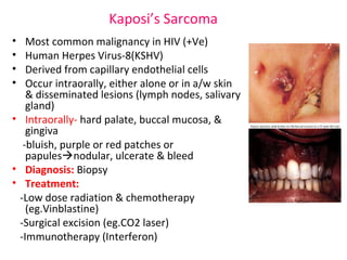 Kaposi’s Sarcoma 
• Most common malignancy in HIV (+Ve) 
• Human Herpes Virus-8(KSHV) 
• Derived from capillary endothelial cells 
• Occur intraorally, either alone or in a/w skin 
& disseminated lesions (lymph nodes, salivary 
gland) 
• Intraorally- hard palate, buccal mucosa, & 
gingiva 
-bluish, purple or red patches or 
papulesnodular, ulcerate & bleed 
• Diagnosis: Biopsy 
• Treatment: 
-Low dose radiation & chemotherapy 
(eg.Vinblastine) 
-Surgical excision (eg.CO2 laser) 
-Immunotherapy (Interferon) 
 