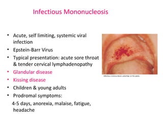 Infectious Mononucleosis 
• Acute, self limiting, systemic viral 
infection 
• Epstein-Barr Virus 
• Typical presentation: acute sore throat 
& tender cervical lymphadenopathy 
• Glandular disease 
• Kissing disease 
• Children & young adults 
• Prodromal symptoms: 
4-5 days, anorexia, malaise, fatigue, 
headache 
 