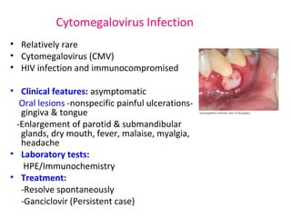 Cytomegalovirus Infection 
• Relatively rare 
• Cytomegalovirus (CMV) 
• HIV infection and immunocompromised 
• Clinical features: asymptomatic 
Oral lesions -nonspecific painful ulcerations-gingiva 
& tongue 
-Enlargement of parotid & submandibular 
glands, dry mouth, fever, malaise, myalgia, 
headache 
• Laboratory tests: 
HPE/Immunochemistry 
• Treatment: 
-Resolve spontaneously 
-Ganciclovir (Persistent case) 
 