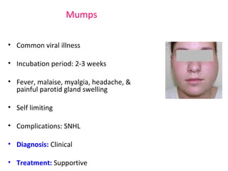 Mumps 
• Common viral illness 
• Incubation period: 2-3 weeks 
• Fever, malaise, myalgia, headache, & 
painful parotid gland swelling 
• Self limiting 
• Complications: SNHL 
• Diagnosis: Clinical 
• Treatment: Supportive 
 
