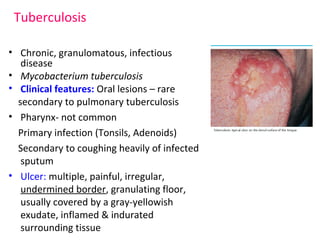 Tuberculosis 
• Chronic, granulomatous, infectious 
disease 
• Mycobacterium tuberculosis 
• Clinical features: Oral lesions – rare 
secondary to pulmonary tuberculosis 
• Pharynx- not common 
Primary infection (Tonsils, Adenoids) 
Secondary to coughing heavily of infected 
sputum 
• Ulcer: multiple, painful, irregular, 
undermined border, granulating floor, 
usually covered by a gray-yellowish 
exudate, inflamed & indurated 
surrounding tissue 
 