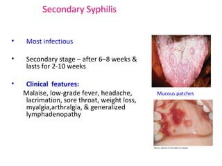Secondary Syphilis 
• Most infectious 
• Secondary stage – after 6–8 weeks & 
lasts for 2-10 weeks 
• Clinical features: 
Malaise, low-grade fever, headache, 
lacrimation, sore throat, weight loss, 
myalgia,arthralgia, & generalized 
lymphadenopathy 
Mucous patches 
 