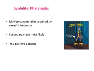 Syphilitic Pharyngitis 
• May be congenital or acquired by 
sexual intercourse 
• Secondary stage most likely 
• HIV positive patients 
 