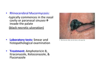 • Rhinocerebral Mucormycosis: 
-typically commences in the nasal 
cavity or paranasal sinuses 
invade the palate 
(black necrotic ulceration) 
• Laboratory tests: Smear and 
histopathological examination 
• Treatment: Amphotericin B, 
Itraconazole, Ketoconazole, & 
Fluconazole 
 