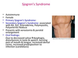 Sjogren’s Syndrome 
• Autoimmune 
• Female 
• Primary Sjogren’s Syndrome: 
• Secondary Sjogren’s Syndrome: associated 
with RA, SLE, Scleroderma, Polymyositis, 
Polyarteritis Nodusa 
• Presents with xerostomia & parotid 
enlargement 
• Oral findings: 
-Due to decreased salivadysphagia, 
disturbances in taste & speech, burning 
pain of mouth & tongue, increased dental 
caries, increased predisposition to 
infection (candidiasis) 
 