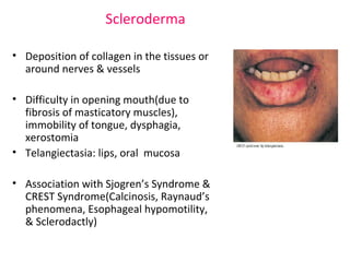 Scleroderma 
• Deposition of collagen in the tissues or 
around nerves & vessels 
• Difficulty in opening mouth(due to 
fibrosis of masticatory muscles), 
immobility of tongue, dysphagia, 
xerostomia 
• Telangiectasia: lips, oral mucosa 
• Association with Sjogren’s Syndrome & 
CREST Syndrome(Calcinosis, Raynaud’s 
phenomena, Esophageal hypomotility, 
& Sclerodactly) 
 