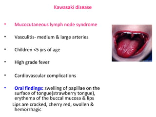 Kawasaki disease 
• Mucocutaneous lymph node syndrome 
• Vasculitis- medium & large arteries 
• Children <5 yrs of age 
• High grade fever 
• Cardiovascular complications 
• Oral findings: swelling of papillae on the 
surface of tongue(strawberry tongue), 
erythema of the buccal mucosa & lips 
Lips are cracked, cherry red, swollen & 
hemorrhagic 
 