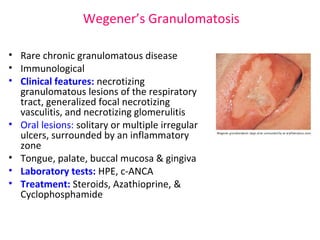 Wegener’s Granulomatosis 
• Rare chronic granulomatous disease 
• Immunological 
• Clinical features: necrotizing 
granulomatous lesions of the respiratory 
tract, generalized focal necrotizing 
vasculitis, and necrotizing glomerulitis 
• Oral lesions: solitary or multiple irregular 
ulcers, surrounded by an inflammatory 
zone 
• Tongue, palate, buccal mucosa & gingiva 
• Laboratory tests: HPE, c-ANCA 
• Treatment: Steroids, Azathioprine, & 
Cyclophosphamide 
 