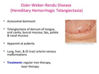 Osler-Weber-Rendu Disease 
(Hereditary Hemorrhagic Telangiectasia) 
• Autosomal dominant 
• Telangiectasia of dorsum of tongue, 
oral cavity, buccal mucosa, lips, palate 
& nasal mucosa 
• Apparent at puberty 
• Lung, liver, & GI tract arterio-venous 
malformations 
• Treatment: regular iron therapy, 
laser therapy 
 