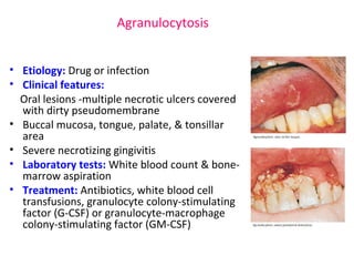 Agranulocytosis 
• Etiology: Drug or infection 
• Clinical features: 
Oral lesions -multiple necrotic ulcers covered 
with dirty pseudomembrane 
• Buccal mucosa, tongue, palate, & tonsillar 
area 
• Severe necrotizing gingivitis 
• Laboratory tests: White blood count & bone-marrow 
aspiration 
• Treatment: Antibiotics, white blood cell 
transfusions, granulocyte colony-stimulating 
factor (G-CSF) or granulocyte-macrophage 
colony-stimulating factor (GM-CSF) 
 