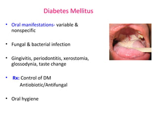 Diabetes Mellitus 
• Oral manifestations- variable & 
nonspecific 
• Fungal & bacterial infection 
• Gingivitis, periodontitis, xerostomia, 
glossodynia, taste change 
• Rx: Control of DM 
Antiobiotic/Antifungal 
• Oral hygiene 
 