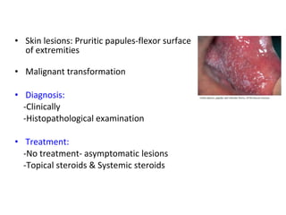 • Skin lesions: Pruritic papules-flexor surface 
of extremities 
• Malignant transformation 
• Diagnosis: 
-Clinically 
-Histopathological examination 
• Treatment: 
-No treatment- asymptomatic lesions 
-Topical steroids & Systemic steroids 
 