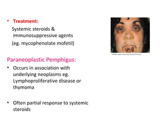 • Treatment: 
Systemic steroids & 
immunosuppressive agents 
(eg. mycophenolate mofetil) 
Paraneoplastic Pemphigus: 
• Occurs in association with 
underlying neoplasms eg. 
Lymphoproliferative disease or 
thymoma 
• Often partial response to systemic 
steroids 
 
