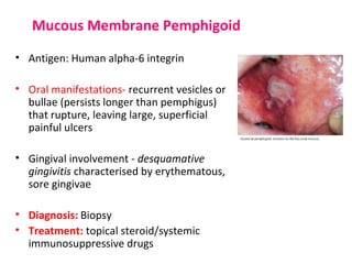 Mucous Membrane Pemphigoid 
• Antigen: Human alpha-6 integrin 
• Oral manifestations- recurrent vesicles or 
bullae (persists longer than pemphigus) 
that rupture, leaving large, superficial 
painful ulcers 
• Gingival involvement - desquamative 
gingivitis characterised by erythematous, 
sore gingivae 
• Diagnosis: Biopsy 
• Treatment: topical steroid/systemic 
immunosuppressive drugs 
 