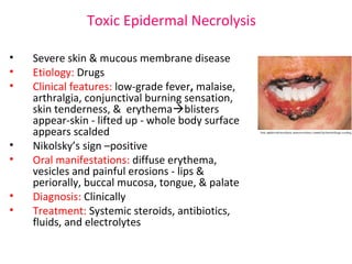 Toxic Epidermal Necrolysis 
• Severe skin & mucous membrane disease 
• Etiology: Drugs 
• Clinical features: low-grade fever, malaise, 
arthralgia, conjunctival burning sensation, 
skin tenderness, & erythemablisters 
appear-skin - lifted up - whole body surface 
appears scalded 
• Nikolsky’s sign –positive 
• Oral manifestations: diffuse erythema, 
vesicles and painful erosions - lips & 
periorally, buccal mucosa, tongue, & palate 
• Diagnosis: Clinically 
• Treatment: Systemic steroids, antibiotics, 
fluids, and electrolytes 
 