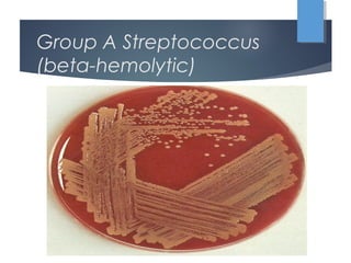 Group A Streptococcus
(beta-hemolytic)
 
