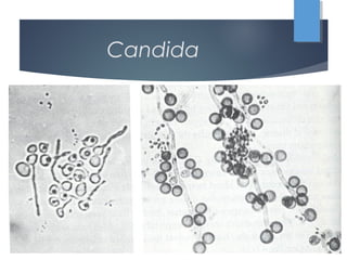 Candida
 