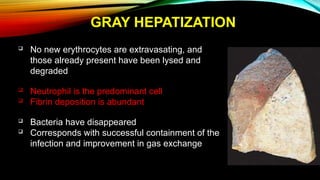 Gray Infection Comprehensive Overview of Pneumonia: Diagnosis, Management, and ...