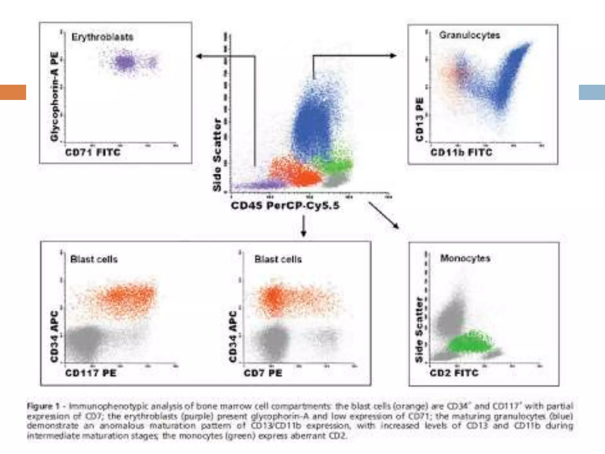 Acute promyelocytic leukemia | PPTX