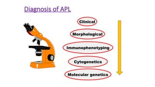 Diagnosis of APL
Clinical
Morphological
Immunophenotyping
Molecular genetics
Cytogenetics
 