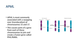 APML
• APML is most commonly
associated with a swapping
over (translocation) of
chromosomes 15 and 17.
• This causes parts of a gene
from each of these
chromosomes to join and
create a fusion gene called
PML/RARA.
 