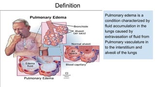 Acute pulmonary edema and its causes .pptx