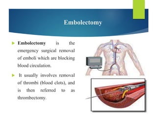 Embolectomy
 Embolectomy is the
emergency surgical removal
of emboli which are blocking
blood circulation.
 It usually involves removal
of thrombi (blood clots), and
is then referred to as
thrombectomy.
 