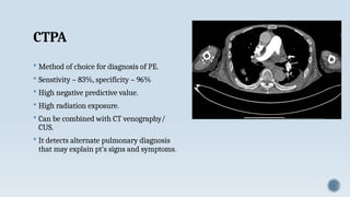 Acute PULMONary embolism diagnosis and management | PPTX