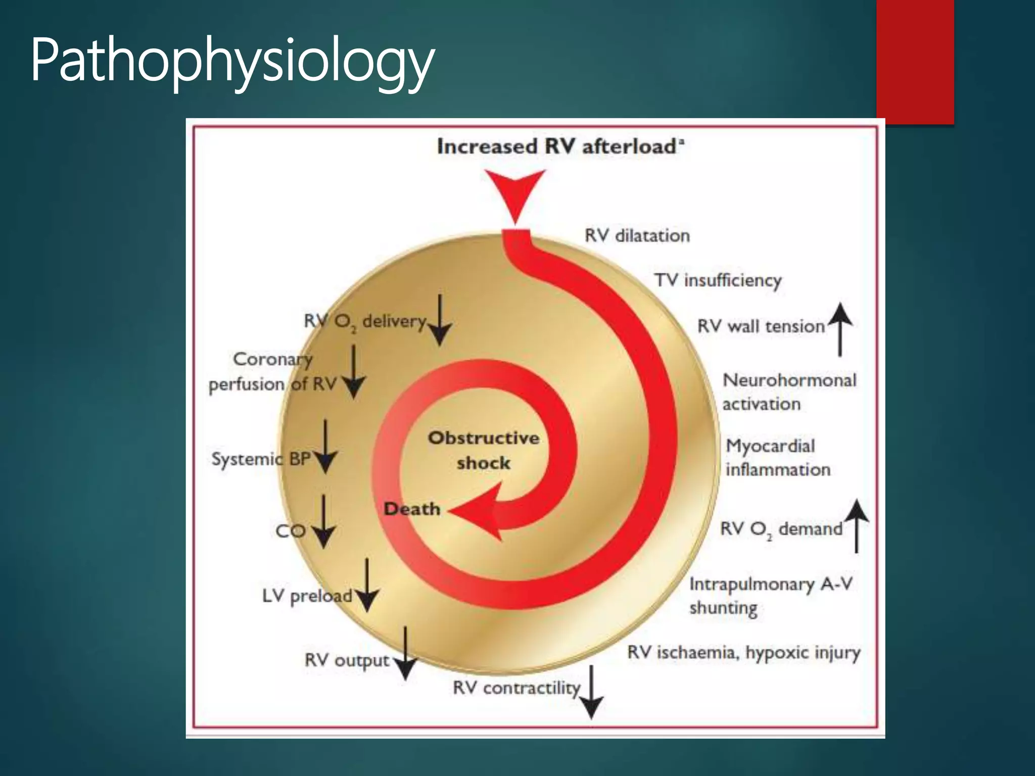 Acute Pulmonary Embolism: Introduction, Clinical presentation ...