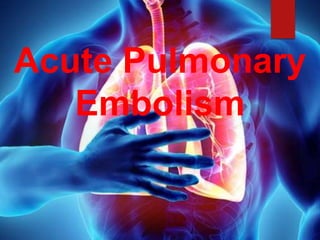 Acute Pulmonary
Embolism
 