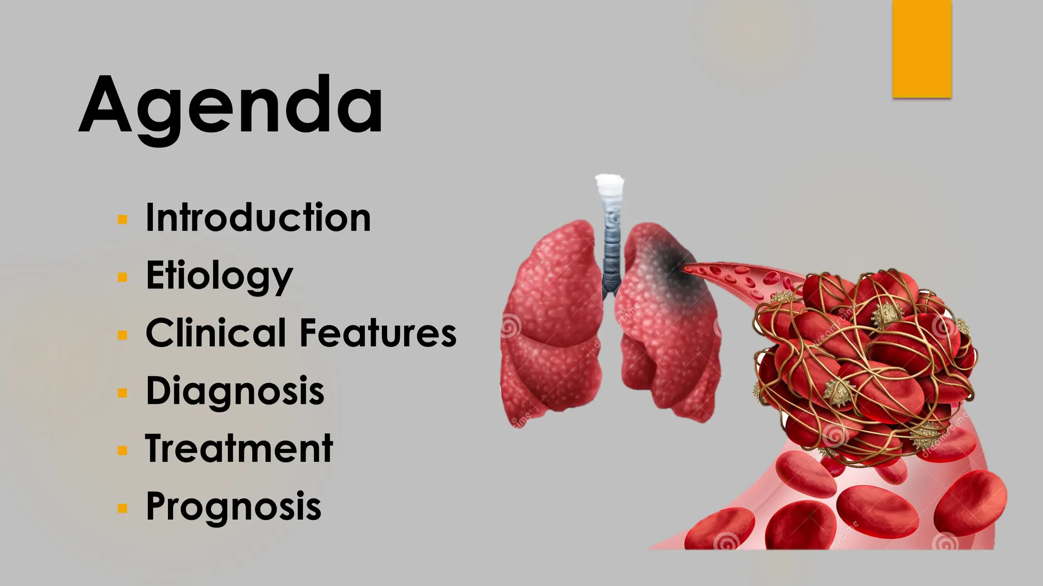 ABDULRAHMAN AL RAFIQ UPDATED MANAGEMENT OF ACUTE PULMONARY EMBOLISM .pdf