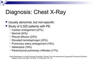 Diagnosis: Chest X-Ray
 Usually abnormal, but non-specific
 Study of 2,322 patients with PE:
 Cardiac enlargement (27%)
 Normal (24%)
 Pleural effusion (23%)
 Elevated hemidiaphragm (20%)
 Pulmonary artery enlargement (19%)
 Atelectasis (18%)
 Parenchymal pulmonary infiltrates (17%)
Chest Radiographs in Acute Pulmonary Embolism: Results From the International Cooperative Pulmonary Embolism
Registry. Chest July 2000 118:3338; 10.1378/chest.118.1.33
 