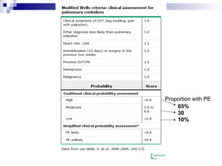 Proportion with PE
65%
30
10%
 