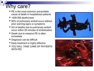 Why care?
 PE is the most common preventable
cause of death in hospitalized patients
 ~600,000 deaths/year
 80% of pulmonary emboli occur without
prior warning signs or symptoms
 2/3 of deaths due to pulmonary emboli
occur within 30 minutes of embolization
 Death due to massive PE is often
immediate
 Diagnosis can be difficult
 Early treatment is highly effective
 YOU WILL TAKE CARE OF PATIENTS
WITH PE!
 