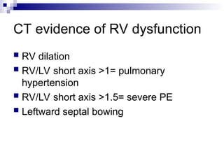 CT evidence of RV dysfunction
 RV dilation
 RV/LV short axis >1= pulmonary
hypertension
 RV/LV short axis >1.5= severe PE
 Leftward septal bowing
 