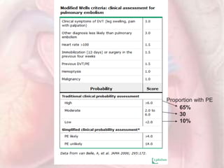 Proportion with PE
65%
30
10%
 